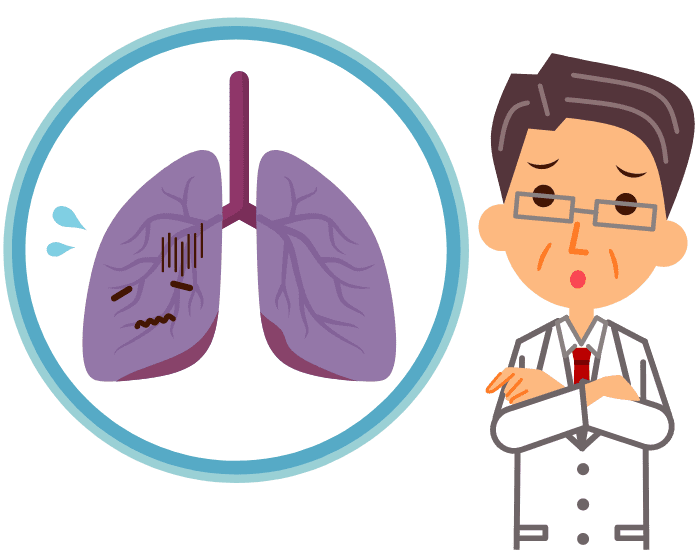 弱っている肺と厳しい顔つきの医者のイラスト