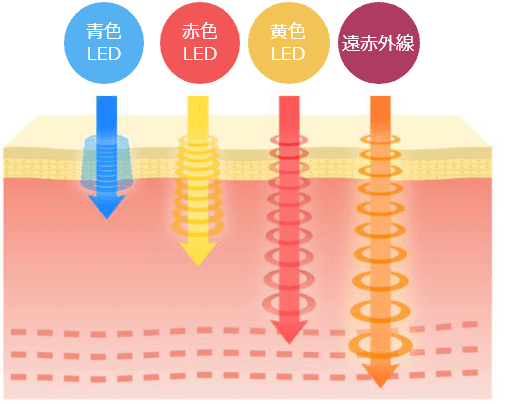 青色LED、赤色LED、黄色LED、遠赤外線LEDの透過の違いを説明するイラスト