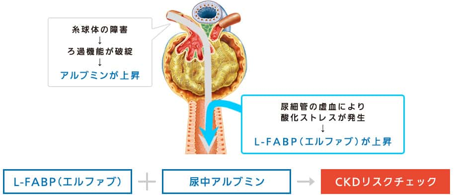 CKDリスクチェック検査