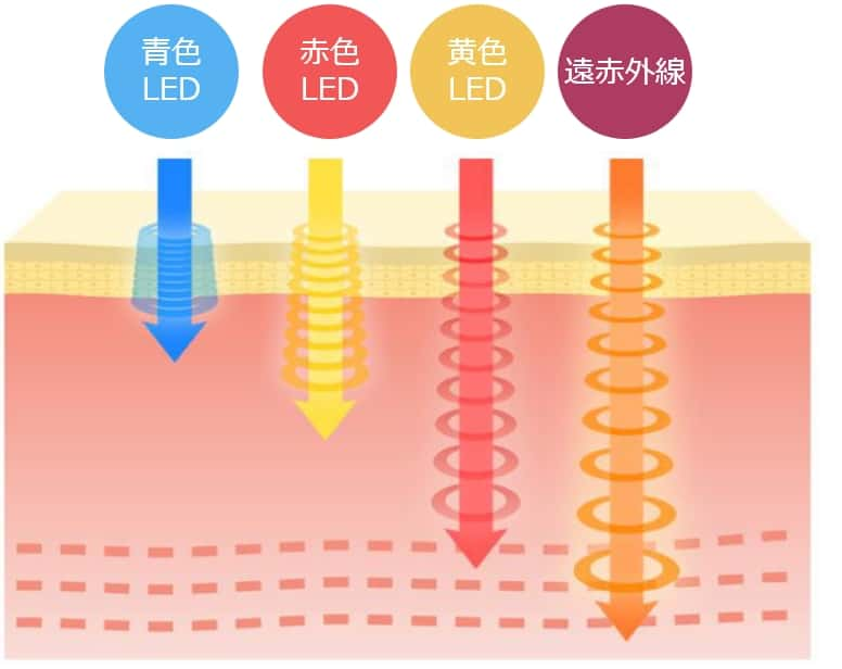 LED近赤外線治療の説明図