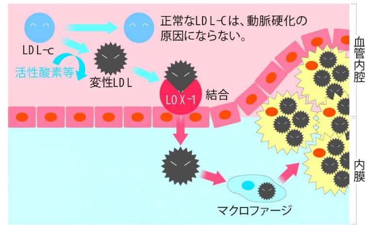 動脈硬化の原因